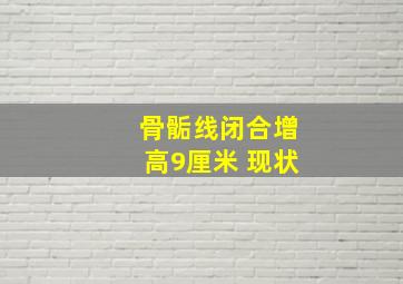 骨骺线闭合增高9厘米 现状